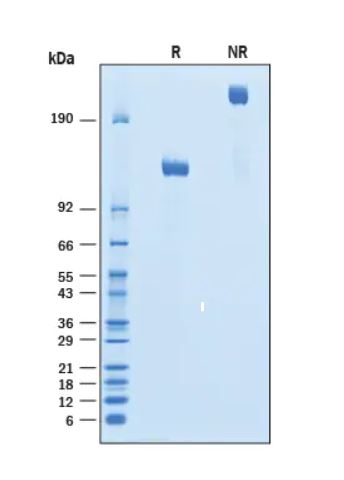 2 μg/lane Protein  was resolved with SDS-PAGE under reducing (R) and non-reducing (NR) conditions and visualized by Coomassie® Blue staining.